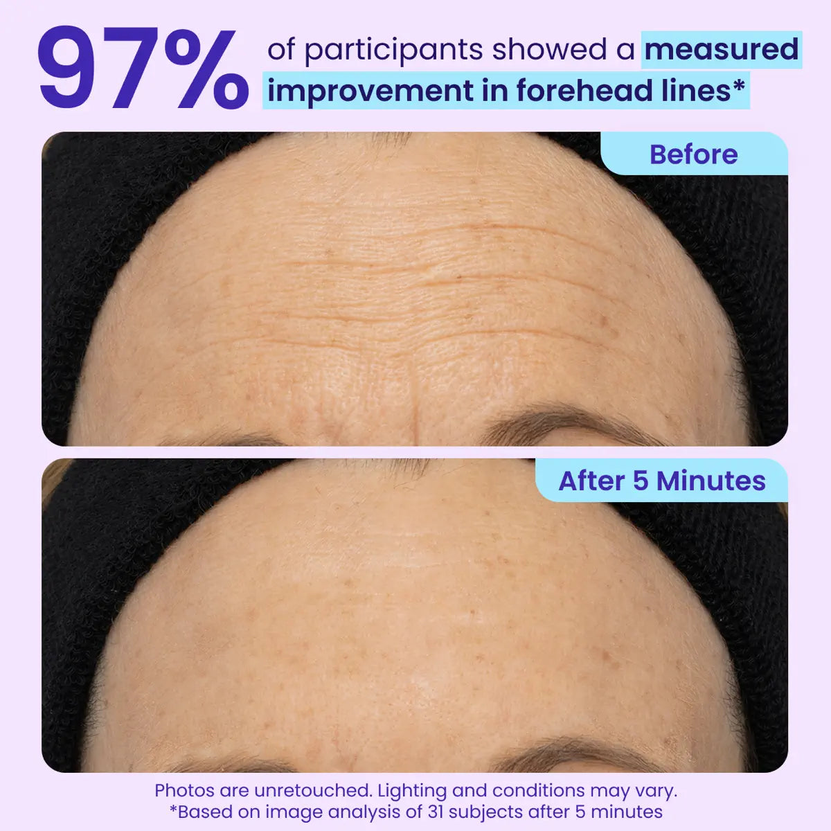 Instant Lift Eye Gel