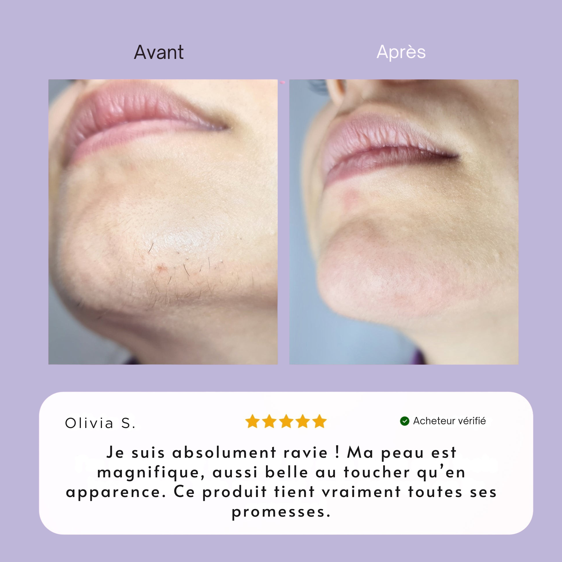 Crème dépilatoire visage Elva.