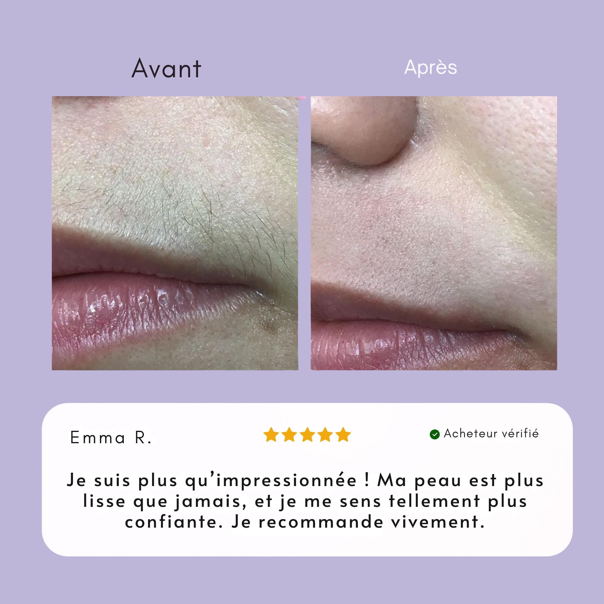 Crème dépilatoire visage Elva.