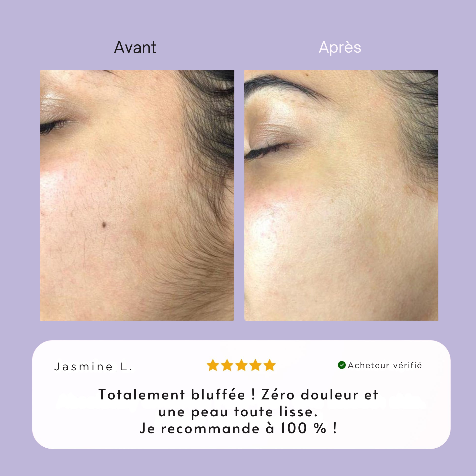 Crème dépilatoire visage Elva.